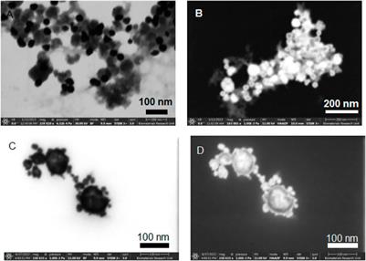 Synthesis of trimetallic iron-boron core and gold shell nanoparticles for experimental cancer radiotherapy